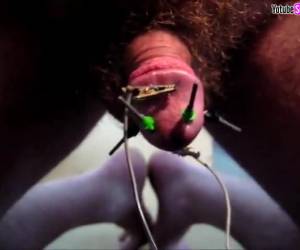 Una polla, cuatro electrodos y una electrocución